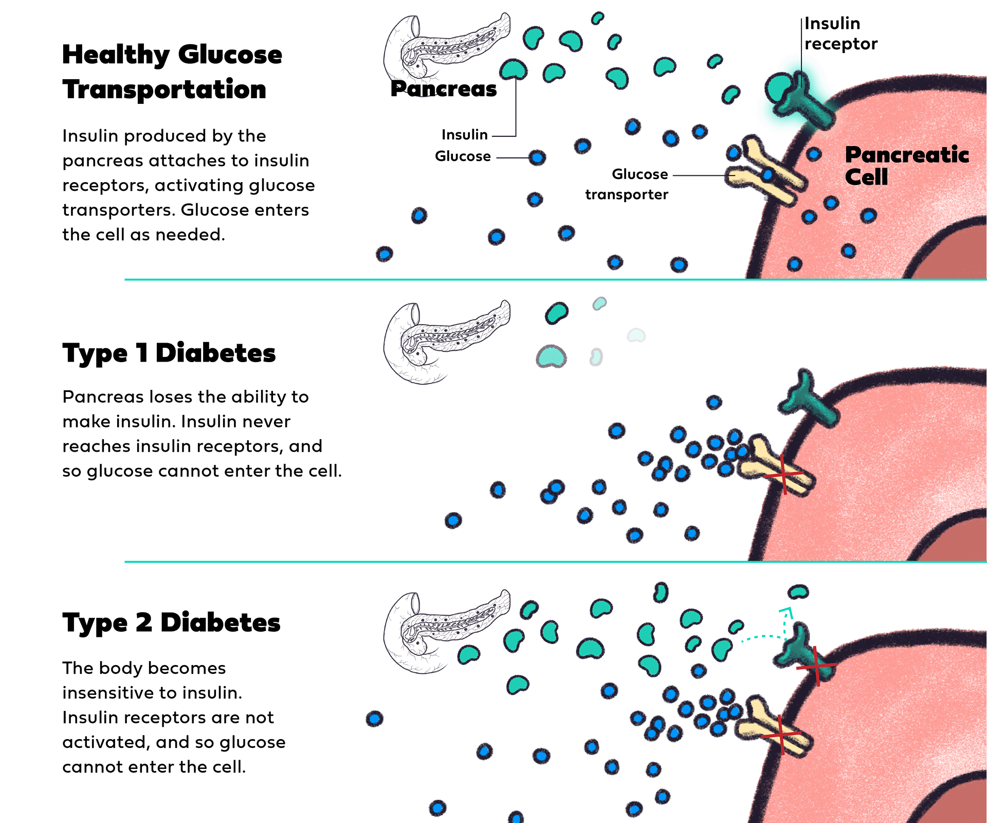 How is T1D different from T2D graphic